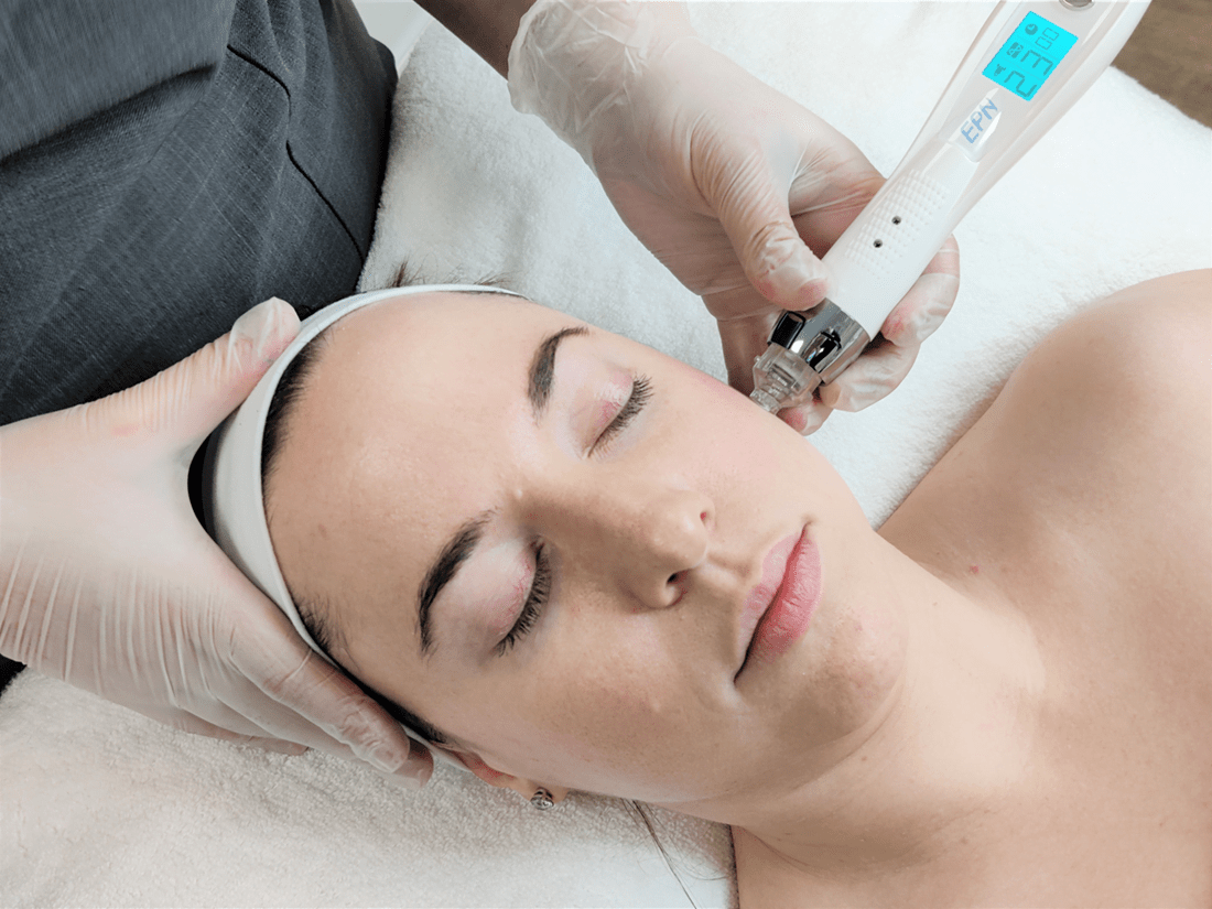 Microneedle mesotherapy (Dr Pen)